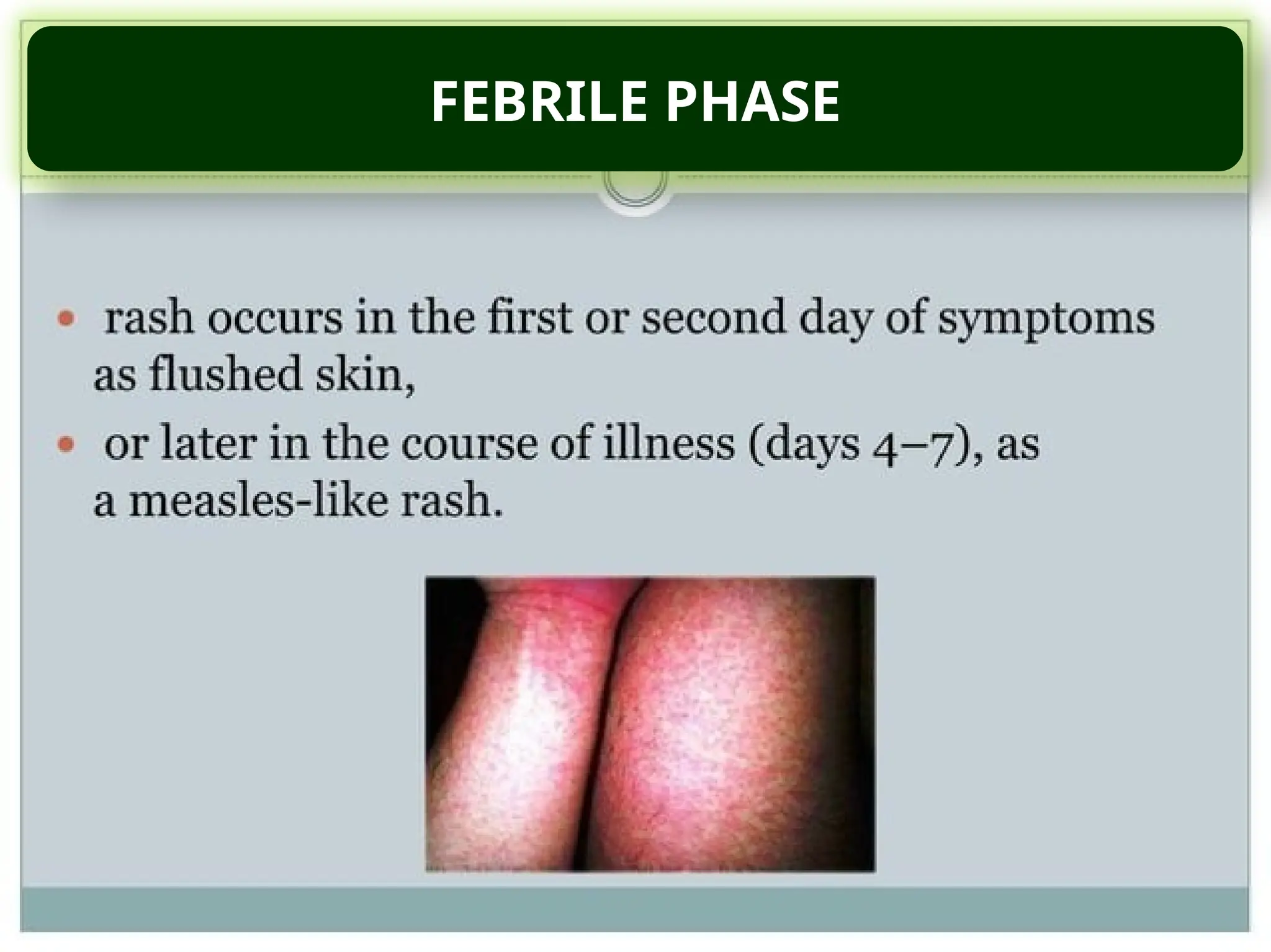 FEBRILE PHASE