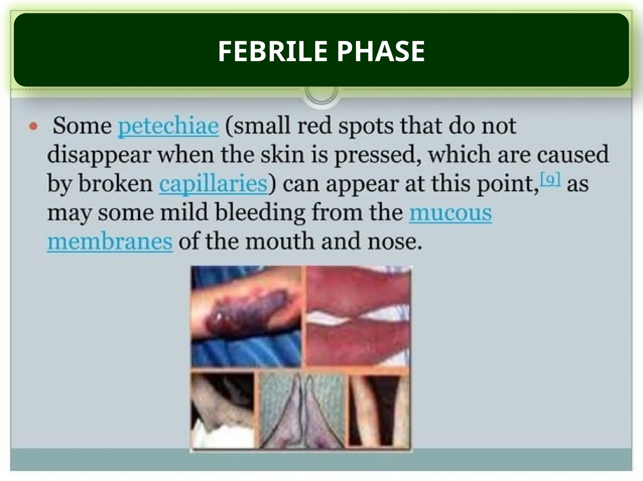 FEBRILE PHASE