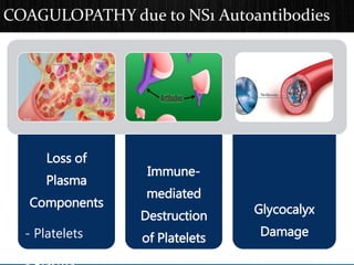 COAGULOPATHY due to NS1 Autoantibodies
Loss of
Plasma
Components
- Platelets
Immune-
mediated
Destruction
of Platelets
Glycocalyx
Damage
 