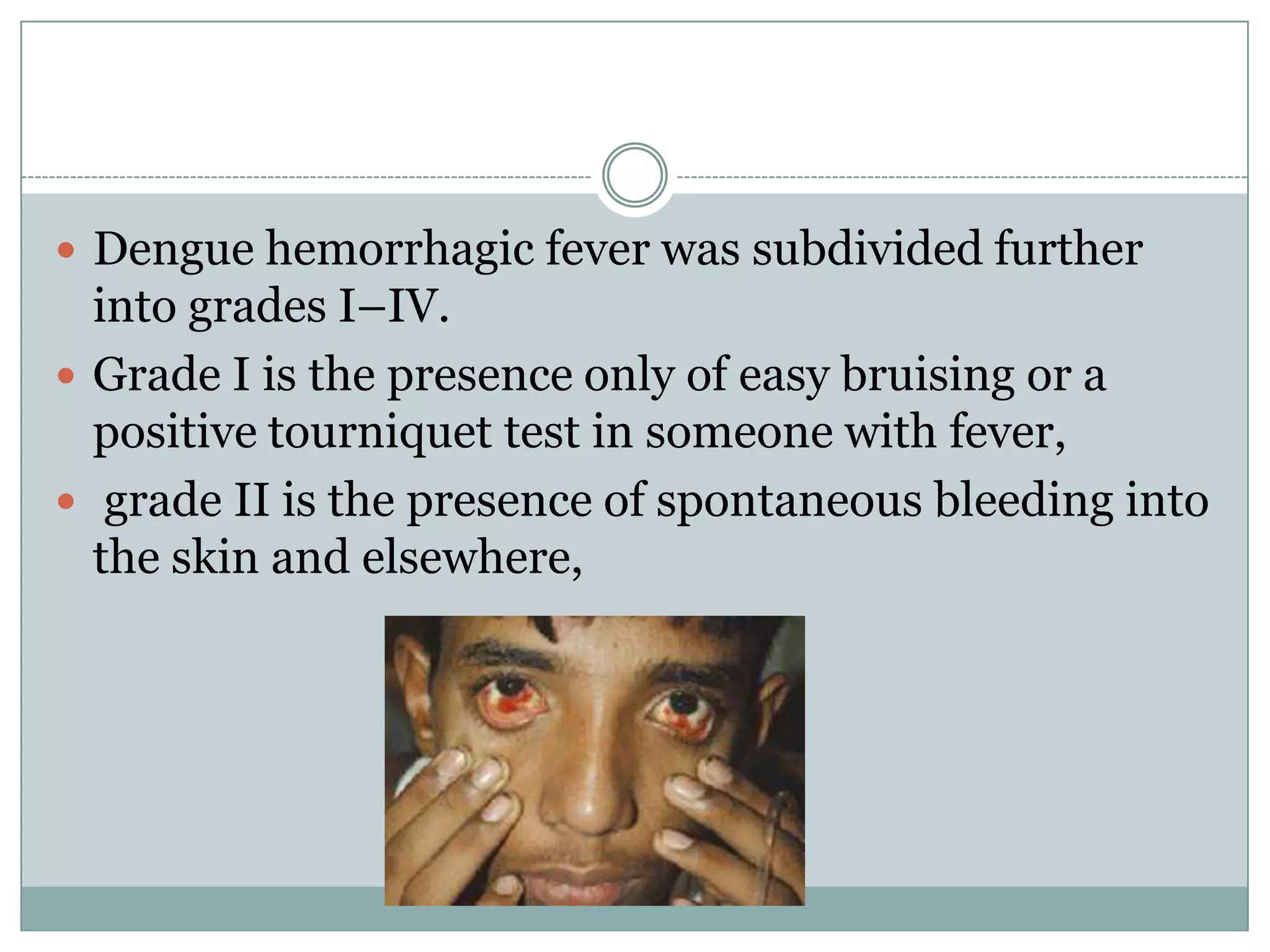  Dengue hemorrhagic fever was subdivided further
  into grades I–IV.
 Grade I is the presence only of easy bruising or a
  positive tourniquet test in someone with fever,
 grade II is the presence of spontaneous bleeding into
  the skin and elsewhere,
 