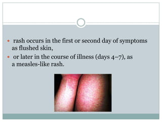  rash occurs in the first or second day of symptoms
  as flushed skin,
 or later in the course of illness (days 4–7), as
  a measles-like rash.
 