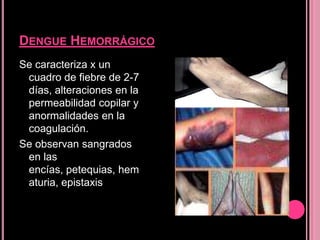 DENGUE HEMORRÁGICO
Se caracteriza x un
 cuadro de fiebre de 2-7
 días, alteraciones en la
 permeabilidad copilar y
 anormalidades en la
 coagulación.
Se observan sangrados
 en las
 encías, petequias, hem
 aturia, epistaxis
 