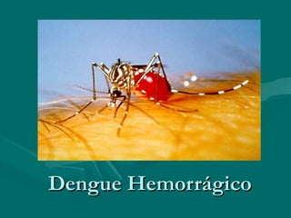 Dengue HemorrágicoDengue Hemorrágico
 