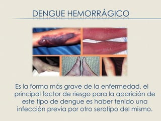 DENGUE HEMORRÁGICO




Es la forma más grave de la enfermedad, el
principal factor de riesgo para la aparición de
   este tipo de dengue es haber tenido una
 infección previa por otro serotipo del mismo.
 