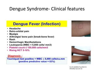 Dengue Syndrome- Clinical features
Cao Xt al(2002);Trop Med Int
Hlth2002;7(2):125-32
 