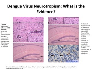 Dengue Virus Neurotropism: What is the
Evidence?
Amaral et al. Intracerebral infection with dengue-3 virus induces meningoencephalitis and behavioural changes that precede lethality in
mice. J Neuroinflamm2011;8:23
E: Normal
hippocampus
F: Neuronal
destruction of
pyramidal
layers of the
hippocampus
G: Cells
staining
positive for
anti-NS3 in
cerebellar
granular layer
H: NS-3
positive cells in
inflammed
cerebrum
Cerebral
involvement
following DEN3
infection:
A: Normal
B:
Meningoenceph
alitis with
immune cell
infiltration of
the meninges
C: Perivascular
cuffing (PC)
D: Vasculitis
 