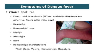 dengue in children.pptx