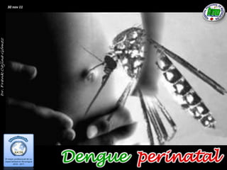 30 nov 11




            Dengue perinatal
 