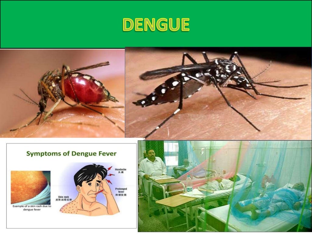 presentation in dengue