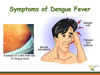 Symptoms of Dengue Fever
Example of a skin rash due
to dengue fever
 