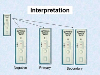 Interpretation
SecondaryPrimaryNegative
 