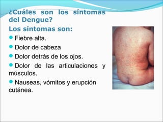 ¿Cuáles son los síntomas
del Dengue?
Los síntomas son:
Fiebre alta.
Dolor de cabeza
Dolor detrás de los ojos.
Dolor de las articulaciones y
músculos.
Nauseas, vómitos y erupción
cutánea.
