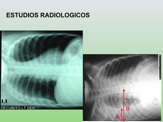 ESTUDIOS RADIOLOGICOS
 
