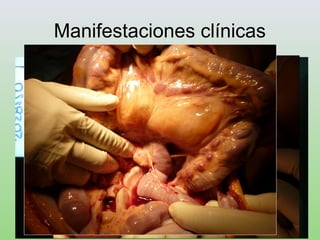 Manifestaciones clínicas
 