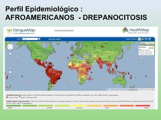 Perfil Epidemiológico :
AFROAMERICANOS - DREPANOCITOSIS
 