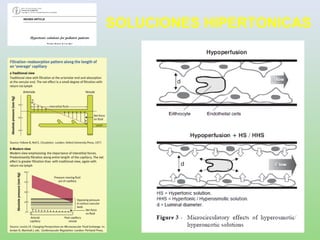 SOLUCIONES HIPERTONICAS
 