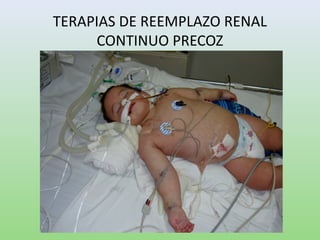 TERAPIAS DE REEMPLAZO RENAL
CONTINUO PRECOZ
 