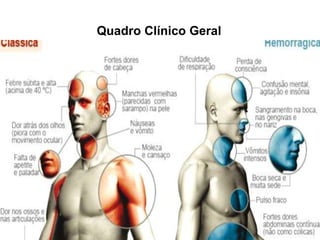Quadro Clínico Geral
 