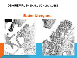 DENGUE VIRUS= SMALL (50NM)VIRUSES
Electron Micrograms
 