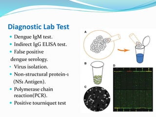 Diagnostic Lab Test
 Dengue IgM test.
 Indirect IgG ELISA test.
 False positive
dengue serology.
• Virus isolation.
 Non-structural protein-1
(NS1 Antigen).
 Polymerase chain
reaction(PCR).
 Positive tourniquet test
 