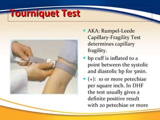 Tourniquet Test AKA: Rumpel-Leede Capillary-Fragility Test determines capillary fragility. bp cuff is inflated to a point between the systolic and diastolic bp for 5min. (+):  10 or more petechiae per square inch. In DHF the test usually gives a definite positive result with 20 petechiae or more 