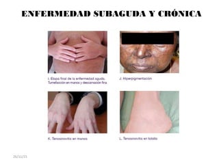 ENFERMEDAD SUBAGUDA Y CRÓNICA
26/11/15
 