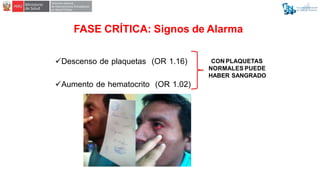 FASE CRÍTICA: Signos de Alarma
Descenso de plaquetas (OR 1.16)
Aumento de hematocrito (OR 1.02)
CON PLAQUETAS
NORMALES P...