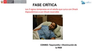 Los 2 signos tempranos en el adulto que cursa con Shock
Hipovolémico o con Shock reversible
COMBO: Taquicardia + Disminuci...