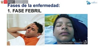 Fases de la enfermedad:
1. FASE FEBRIL
 