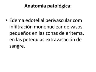 Anatomia patológica:
• Edema edotelial perivascular com
infiltración mononuclear de vasos
pequeños en las zonas de eritema,
en las petequias extravasación de
sangre.
 