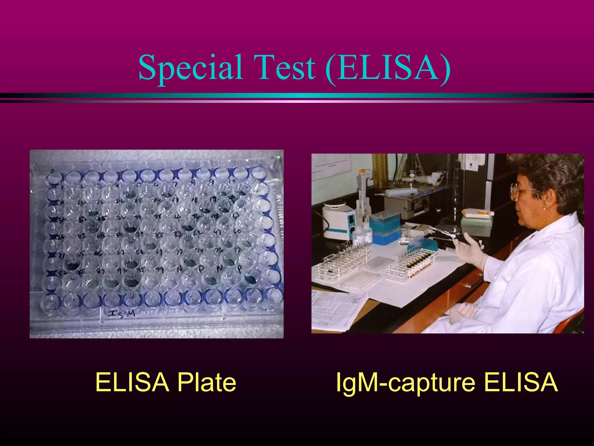 Special Test (ELISA)

ELISA Plate

IgM-capture ELISA

 