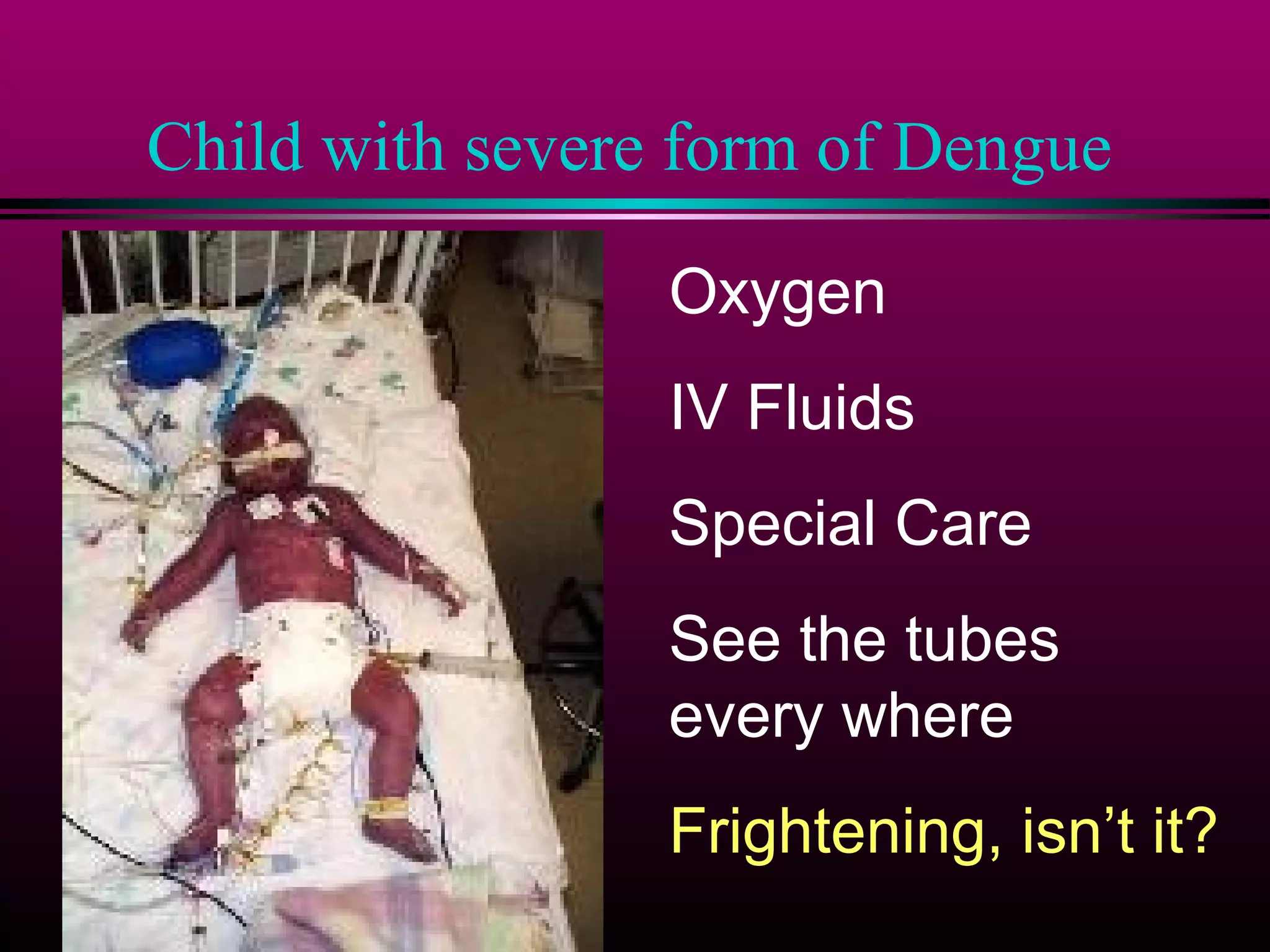 Child with severe form of Dengue
Oxygen
IV Fluids
Special Care
See the tubes
every where
Frightening, isn’t it?

 
