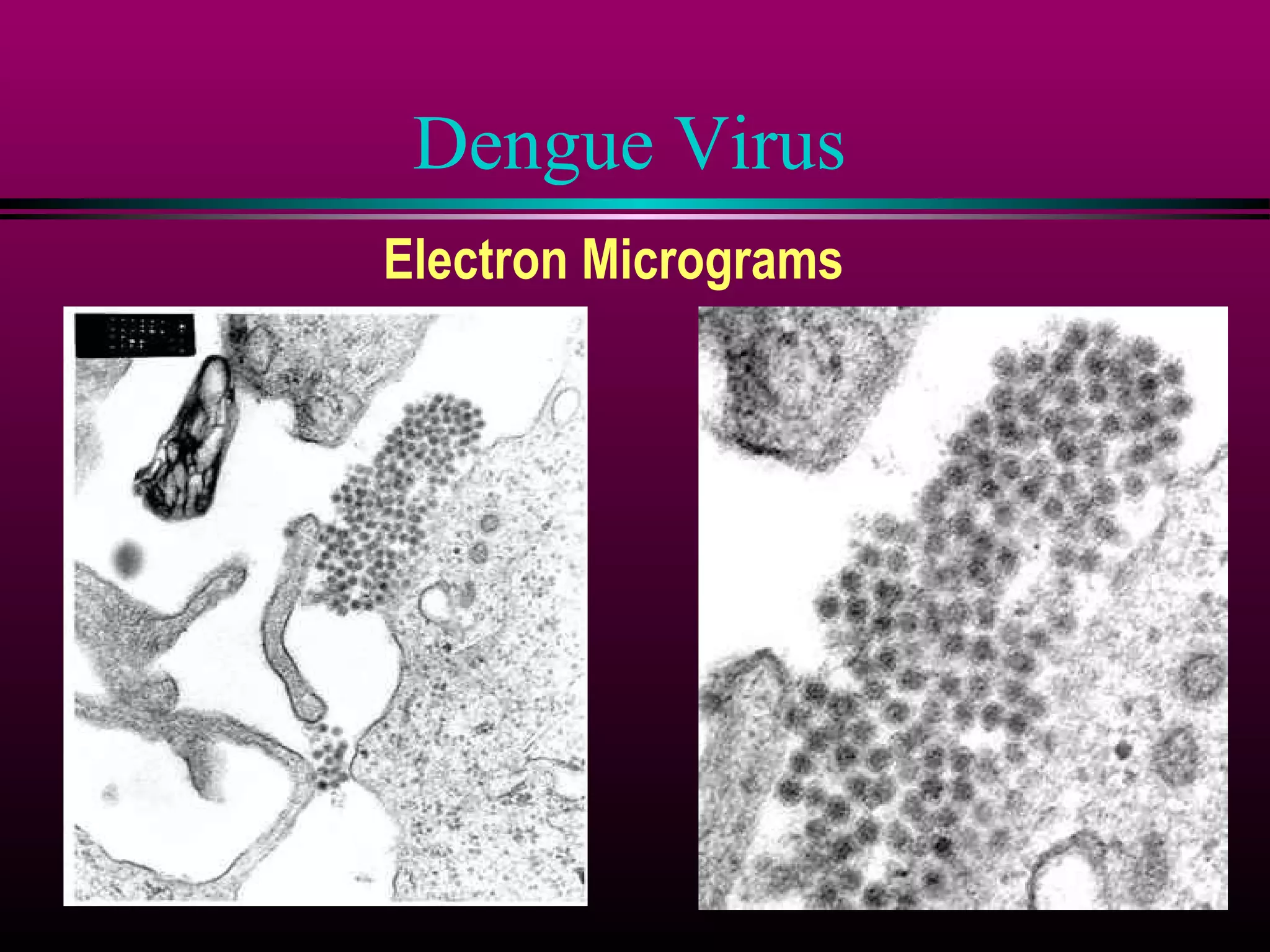 Dengue Virus
Electron Micrograms

 