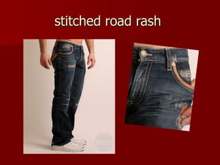 stitched road rash  