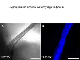 Выращивание отдельных структур нефрона 