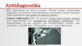 Attēldiagnostika
• CT- pacientiem ar galvas traumu. Būtiski izslēgt intrakraniālu
asiņošanu, lai izvērtētu neiroķirurģiskas iejaukšanās nepieciešamību.
Šajā izmeklējumā tiek atklāts deniņkaula lūzums.
• Augstas izšķirtspējas CT- var noteikt deniņu kaula lūzuma apmēru,
kas nepieciešams pie komplikāciju ķirurģiskas ārstēšanas. Nav
nepieciešams, ja nav aizdomu par komplikācijām (iekšējo auss
struktūru, n.facialis boj., CSŠ noplūde, u.c.). 1mm izšķirtspēja.
http://emedicine.medscape.com/article/857365-workup
 
