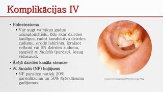 • Holesteatoma
 Var augt vairākus gadus
asimptomātiski, līdz skar dzirdes
kauliņus, radot konduktīvu dzirdes
zudumu, erodē labirintā, izraisot
reiboni vai SN dzirdes zudumu,
saspiež n. facialis (parēze), ieaug
vidusausī.
• Ārējā dzirdes kanāla stenoze
• N. facialis (NF) bojājums
 NF paralīze notiek 20%
garenlūzumu un 50% šķērslūzumu
gadījumos.
http://geoutreach.org/page6/page27/files/stacks_image_779.jpg
Komplikācijas IV
 