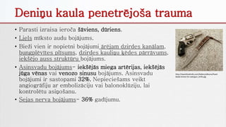 Deniņu kaula penetrējoša trauma
• Parasti izraisa ieroča šāviens, dūriens.
• Liels mīksto audu bojājums.
• Bieži vien ir nopietni bojājumi ārējam dzirdes kanālam,
bungplēvītes plīsums, dzirdes kauliņu ķēdes pārrāvums,
iekšējo auss struktūru bojājums.
• Asinsvadu bojājums- iekšējās miega artērijas, iekšējās
jūga vēnas vai venozo sinusu bojājums. Asinsvadu
bojājumi ir sastopami 32%. Nepieciešams veikt
angiogrāfiju ar embolizāciju vai balonoklūziju, lai
kontrolētu asiņošanu.
• Sejas nerva bojājums- 36% gadījumu.
http://iwantthatknife.com/Gallery/albums/fixed-
blade-knives-for-sale/gun_knife.jpg
 