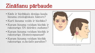 Zināšanu pārbaude
• Kāds ir biežākais deniņu kaula
lūzuma etioloģiskais faktors?
• Kurš lūzuma veids ir biežāks?
• Kuram lūzuma veidam biežāk ir
raksturīgs SN dzirdes zudums?
• Kuram lūzuma veidam biežāk ir
raksturīgs Hemotympanum?
• Kuram lūzuma veidam biežāk
raksturīga n.facialis paralīze?
http://pocketdentistry.com/wp-content/uploads/285/Ch09_image001.jpg
 