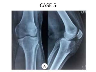 CASE 5
 