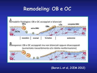 Remodeling: OB e OC
(Baron L et al, JCEM 2012)
Remodelin fisiologico: OB e OC accoppiati e bilanciati
Osteoporosi: OB e OC...