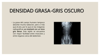 Densidades Radiologicas Y Partes Del Equipo De Rayos X pptx