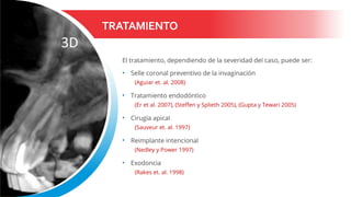 TRATAMIENTO
El tratamiento, dependiendo de la severidad del caso, puede ser:
• Selle coronal preventivo de la invaginación
(Aguiar et. al. 2008)
• Tratamiento endodóntico
(Er et al. 2007), (Steffen y Splieth 2005), (Gupta y Tewari 2005)
• Cirugía apical
(Sauveur et. al. 1997)
• Reimplante intencional
(Nedley y Power 1997)
• Exodoncia
(Rakes et. al. 1998)
 
