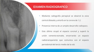 EXAMEN RADIOGRAFICO
• Mediante radiografía periapical se observó la zona
central dilatada y amorfa en la corona de 1.2.
• Presencia interna de un amplio desarrollo radiopaco.
• Este último ocupó el espacio coronal y superó la
unión cemento-esmalte, encerrando un espacio
radiotransparente que comunica con el espacio
periodontal del tercio medio de la raíz
 