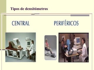Tipos de densitómetros 