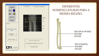 DIFERENTES
NOMENCLATURAS PARA A
MESMA REGIÃO.
 