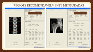 REGIÕES RECOMENDAVELMENTE MENSURADAS
 