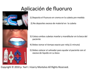 Aplicación de fluoruro
                            1) Deposita el Fluoruro en crema en la cubeta pre-medida

                            2) No deposites exceso de material en la cubeta




                            3) Coloca ambas cubetas maxilar y mandibular en la boca del
                               paciente

                            4) Debes tomar el tiempo exacto por reloj (1 minuto)

                            5) Debes colocar el salivador para ayudar al paciente con el
                               exceso de liquído en su boca




Copyright © 2010 p. Yael I. Irizarry Montalvo All Rights Reserved.
 