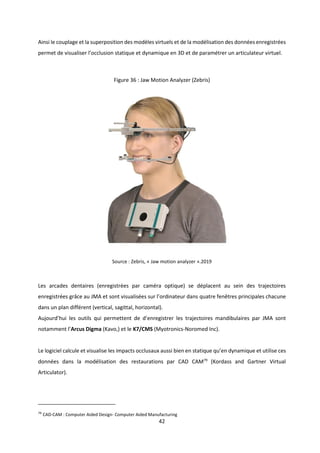 44
Figure 37 : Interface de l’articulateur virtuel DentCam
Source : Kordaß et al., « The virtual articulator in dentistry ...