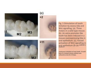 Dental-anomalies-and-genetics2.pdf